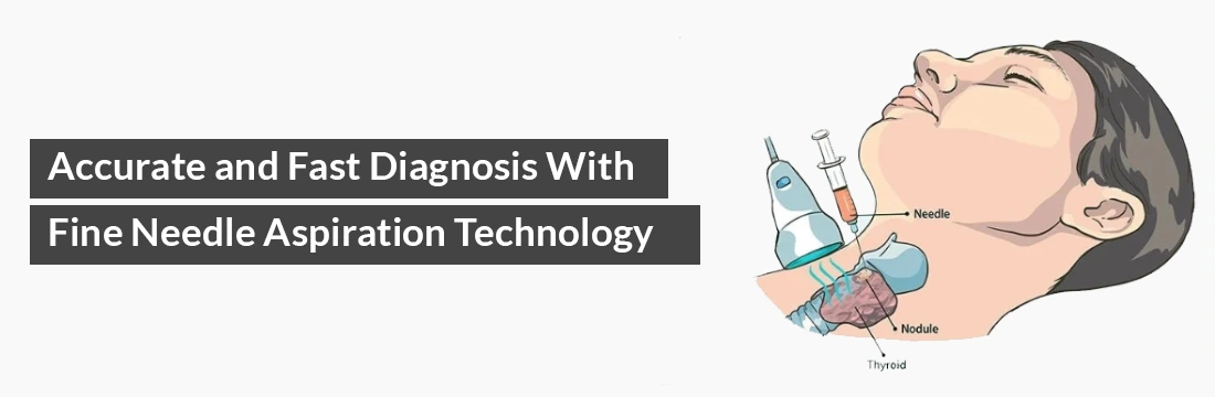  Accurate and Fast Diagnosis With Fine Needle Aspiration Technology